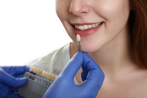 Грижа за циркониеви корони: 5 Правила за Идеална Орална Хигиена