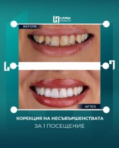 холивудска усмивка преди и след резултат